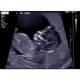 Babylist Registry Photo.