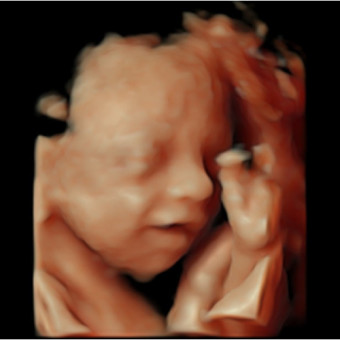 Babylist Registry Photo.