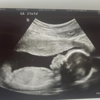 Babylist Registry Photo.