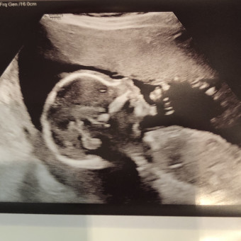 Babylist Registry Photo.