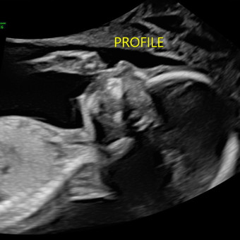 Babylist Registry Photo.