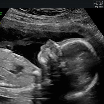 Babylist Registry Photo.