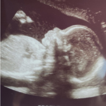 Babylist Registry Photo.
