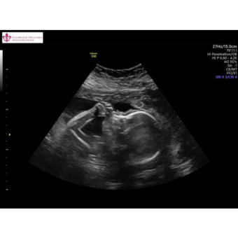 Babylist Registry Photo.