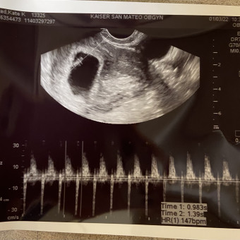 Babylist Registry Photo.