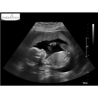 Babylist Registry Photo.
