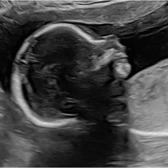Babylist Registry Photo.