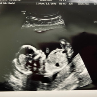 Babylist Registry Photo.