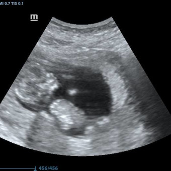 Babylist Registry Photo.