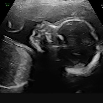 Babylist Registry Photo.