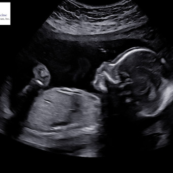Babylist Registry Photo.