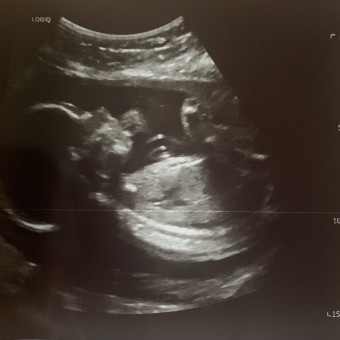 Babylist Registry Photo.