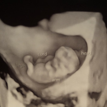 Babylist Registry Photo.
