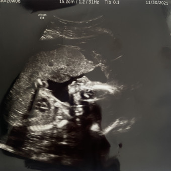 Babylist Registry Photo.