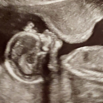 Babylist Registry Photo.