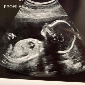 Babylist Registry Photo.