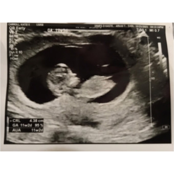 Babylist Registry Photo.
