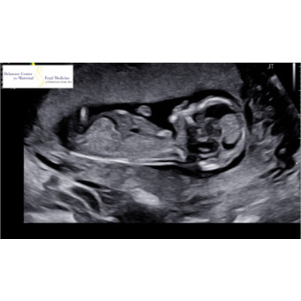 Babylist Registry Photo.