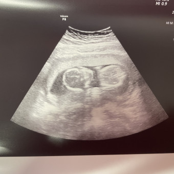 Babylist Registry Photo.