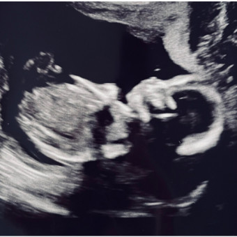 Babylist Registry Photo.