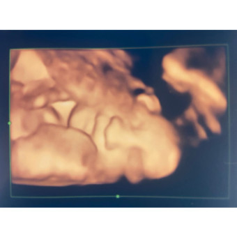 Babylist Registry Photo.
