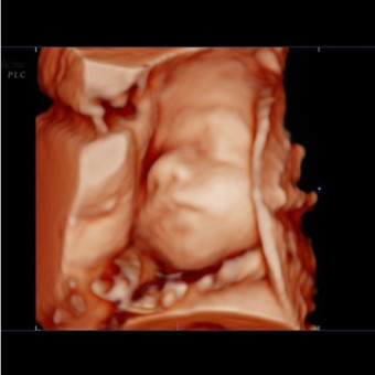 Babylist Registry Photo.