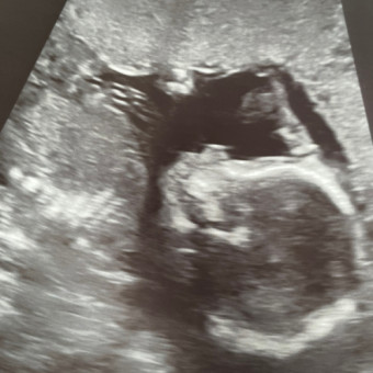 Babylist Registry Photo.