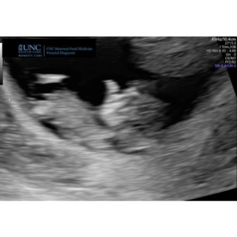 Babylist Registry Photo.