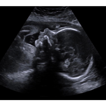 Babylist Registry Photo.