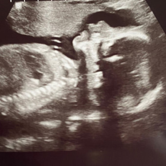 Babylist Registry Photo.