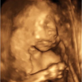 Babylist Registry Photo.
