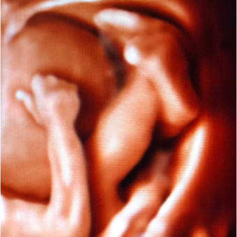 Babylist Registry Photo.