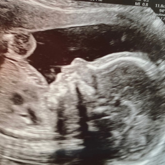 Babylist Registry Photo.
