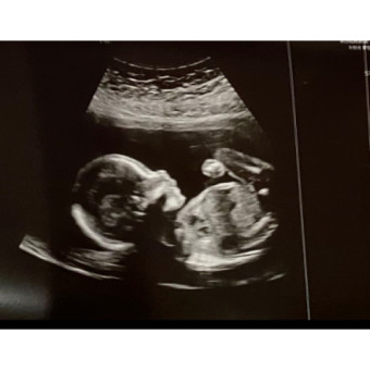 Babylist Registry Photo.