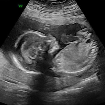 Babylist Registry Photo.