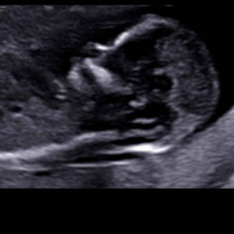 Babylist Registry Photo.
