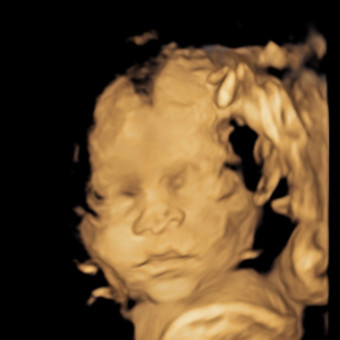Babylist Registry Photo.