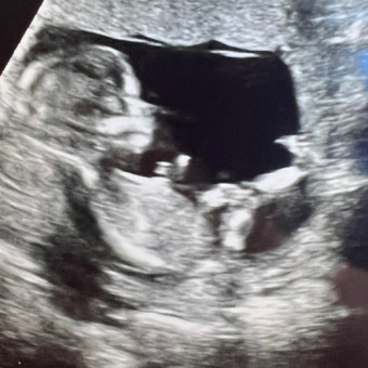 Babylist Registry Photo.