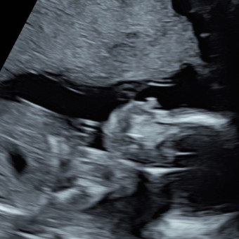 Babylist Registry Photo.