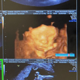 Babylist Registry Photo.
