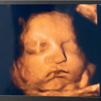 Babylist Registry Photo.