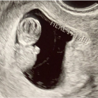 Babylist Registry Photo.
