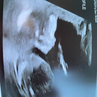 Babylist Registry Photo.