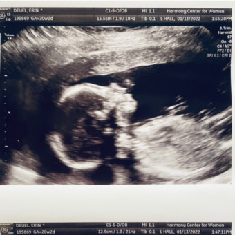 Babylist Registry Photo.