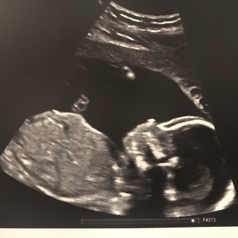 Babylist Registry Photo.
