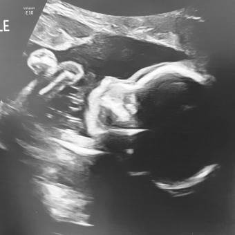 Babylist Registry Photo.