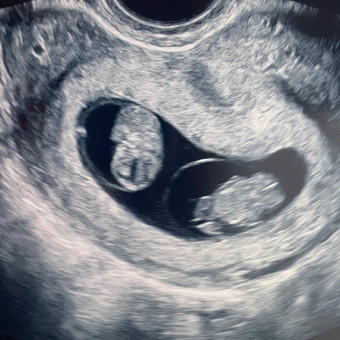 Babylist Registry Photo.