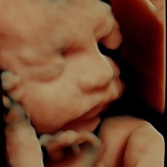 Babylist Registry Photo.