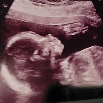 Babylist Registry Photo.