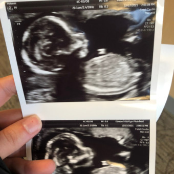 Babylist Registry Photo.